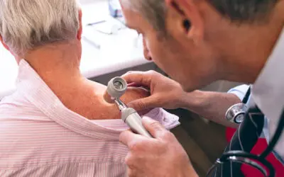 Everything to Know about Squamous Cell Carcinoma