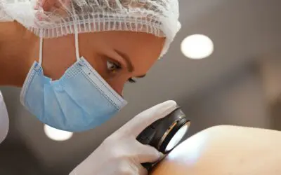 How to Spot Skin Cancer