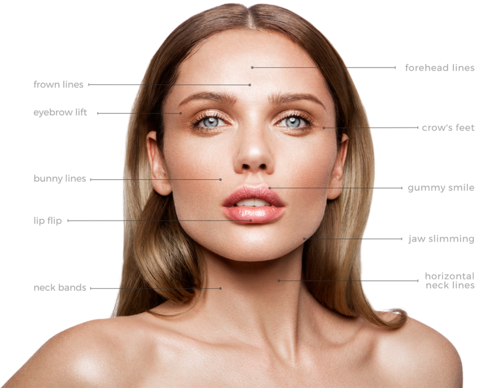 Botox areas to address on a persons face and neck