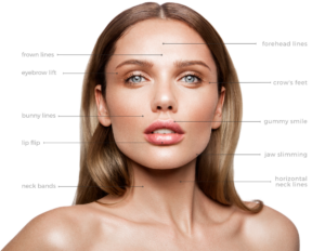 Botox areas to address on a persons face and neck