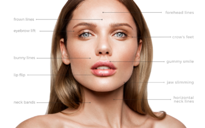 Preventative Boxox in Your 20s