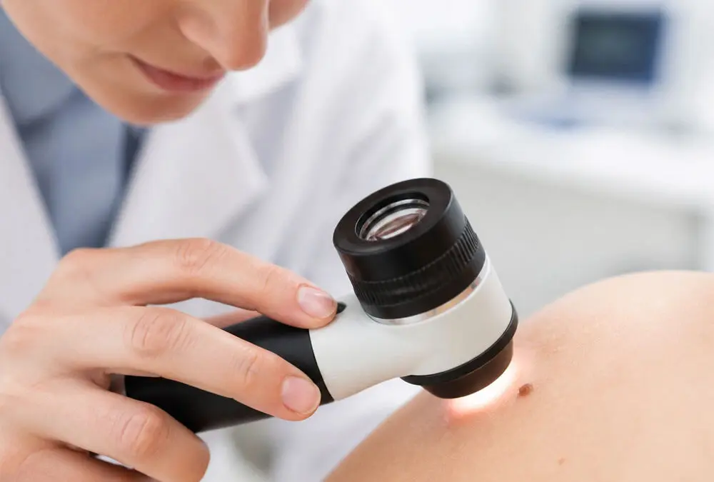 Can AI Apps Really Detect Skin Cancer?