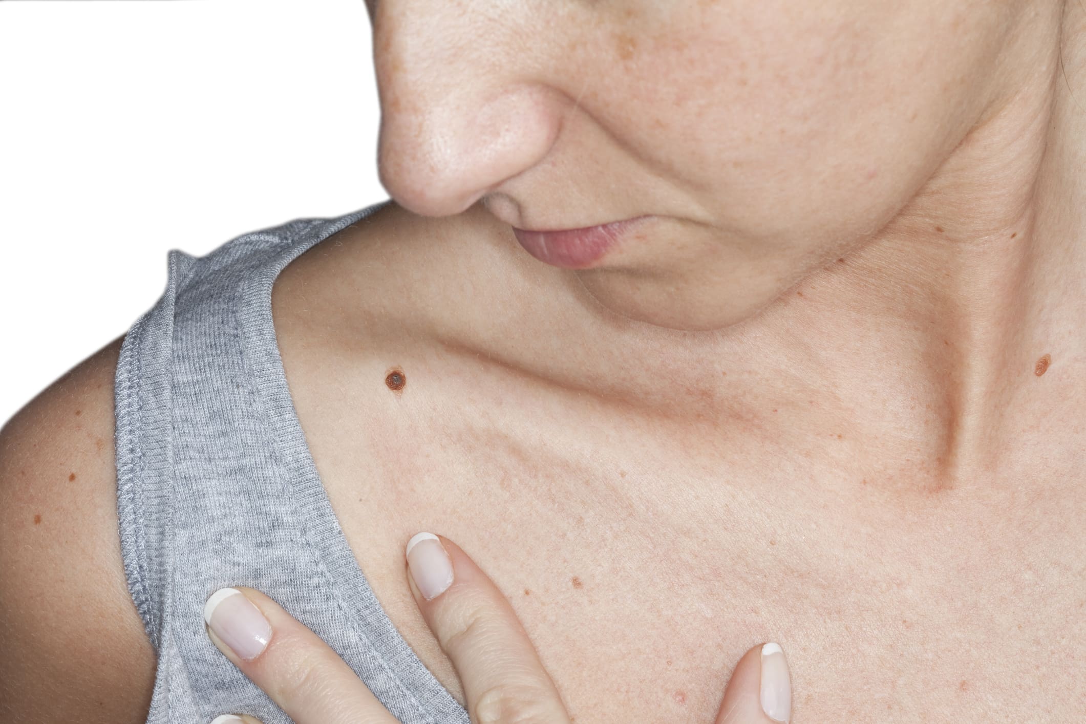 Woman self-examining skin for potential cancerous growths Skin Cancer in Phoenix, AZ